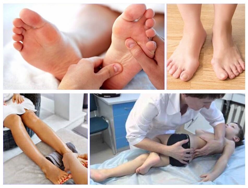 Valgus deformation in children treatment